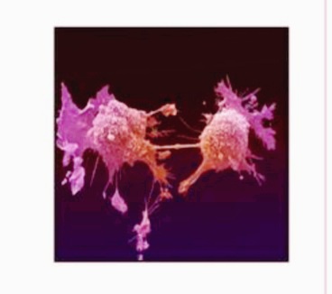 أي من الجمل الآتية صحيح فيما يتعلق بمرض السرطان